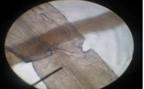 Gambar 2. Vesikula pada akar yang terinfeksi mikoriza 
