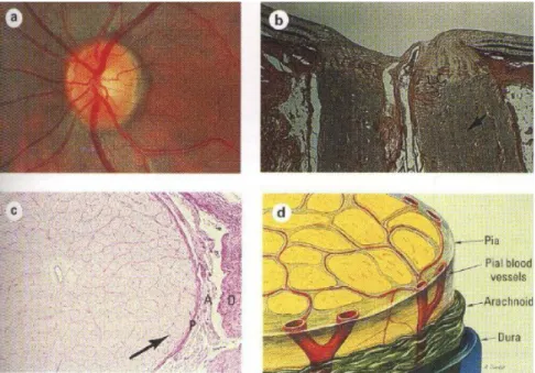Gambar 2 . struktur nervus optik (a) gambaran klinis yang tampak pada oftalmoskop, (b) potongan longitudinal, LC : lamina cribrosa, (c) potongan melintang, P : pia; A : arachnoid; D : dura, (d)