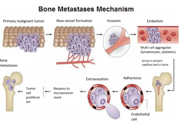 Gambar 2 : Mekanisme terjadinya metastasis tulang 16