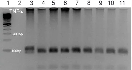 Gambar 1. Hasil RFLP Gen TNF-α  -308G>A (sampel gambar diambil dari 