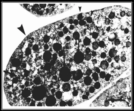 Gambar 1. bersilia (kepala panah) menunjukkan 2 tipe granula osmofilik dan nonosmofilik (kepala panah kecil).Sel Clara (panah kecil), sel epitel (panah besar) dan sel Clara   4 