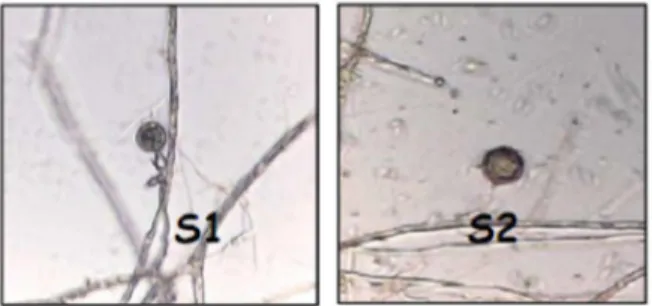 Gambar 3.  Morfologi  Sporangia  Phytophthora  Palmivora  Pada  Media  Henniger  Agar  (S1),  Dan  Sporangia  Pada  Buah  Kakao  Yang  Terserang  Busuk  Buah (S2)