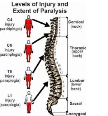 Gambar 5 : manifestasi plegi pada trauma medulla spinalis  (6)