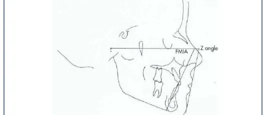 Gambar 8. FMIA. Tweed menggunakan FMIA sebagai indikator keseimbangan  wajah. 7 