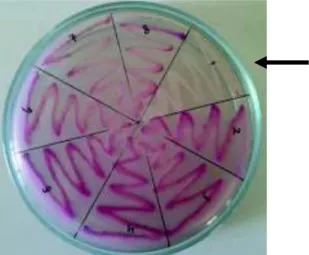 Gambar 1.   Pertumbuhan E.coli O157 pada media SMAC. Koloni E. coli O157 (         ) terlihat  colourless pada media SMAC