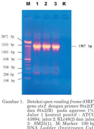 Gambar 1. Deteksi open reading frame (ORF) gene stx2  dengan primer Stx2(F) dan Stx2(R)  pada agarose 1%.