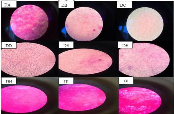 Gambar  4  Gambaran  mikroskopik  dari  pengecatan  gram  yang  diambil  dari  sampel    pada  media  McConkey  memperlihatkan  koloni yang berbentuk coccobasil dan berwarna merah muda 