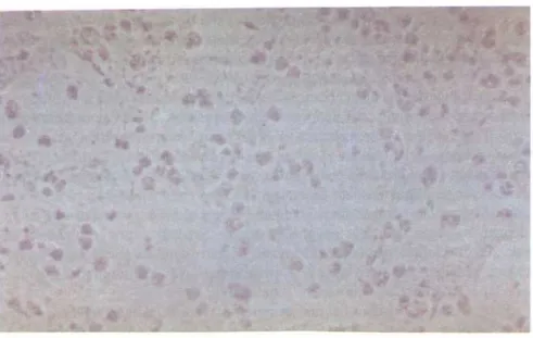 Gambar 1 . Biakanjaringan sel vero yang diinokulasi dengan supernatan E.