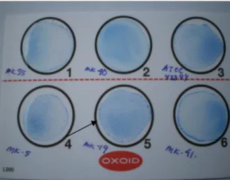 Gambar  1.  Koloni  E.  coli  O157  pada  media  sorbitol  MacConkey  agar  (Nomor  1  dan  2:  Isolat  lokal  E