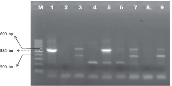 Gambar 1  Elektroforesis produk PCR 8 Isolat E.coli O157:H7 dan 1 isolat kontrol  pada agarose 1%