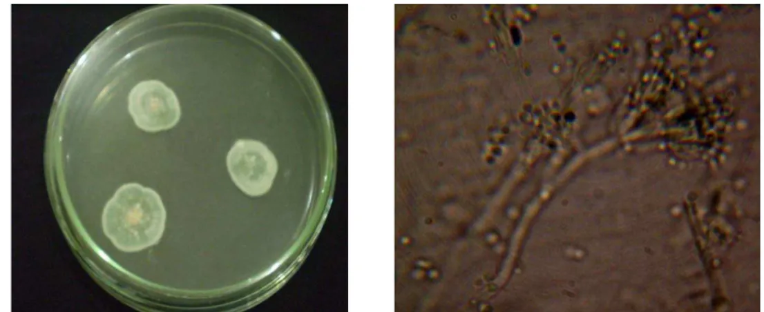 Gambar 1:   Morfologi koloni biakan jamur  sp. secara makroskopi                      (kiri) dan mikroskopi perbesaran 400x (kanan)