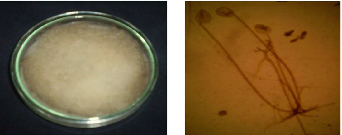 Gambar  4:  Morfologi  koloni  biakan  jam sp   secara  makroskopi                       (kiri) dan mikroskopi perbesaran 1000x (kanan).