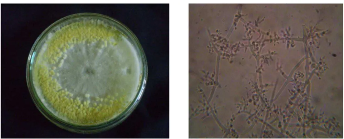 Gambar 5. Morfologi koloni biakan jamur  sp  secara makroskopi  (kiri) dan mikroskopi perbesaran 400 