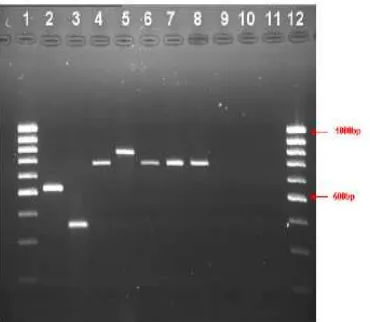 Gambar 2.8  Elektroforesis Gel Agarose untuk Amplifikasi Hasil PCR  dalam Menemukan Elemen Jamur pada Onikomikosis 