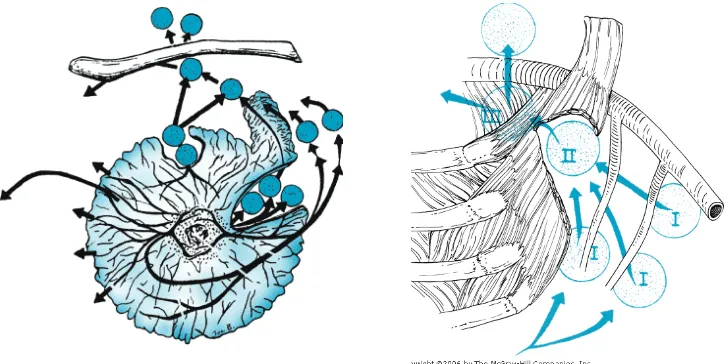 Gambar 2.8. Kelompok kelenjar getah bening aksila. Level I meliputi beberapa kelenjar getah bening yang terletak lateral dari M
