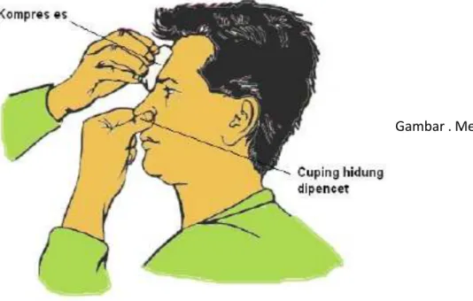 Gambar . Metode Trotter