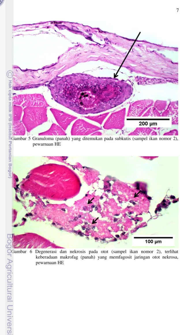Gambar  5  Granuloma  (panah)  yang  ditemukan  pada  subkutis  (sampel  ikan  nomor  2),  pewarnaan HE 