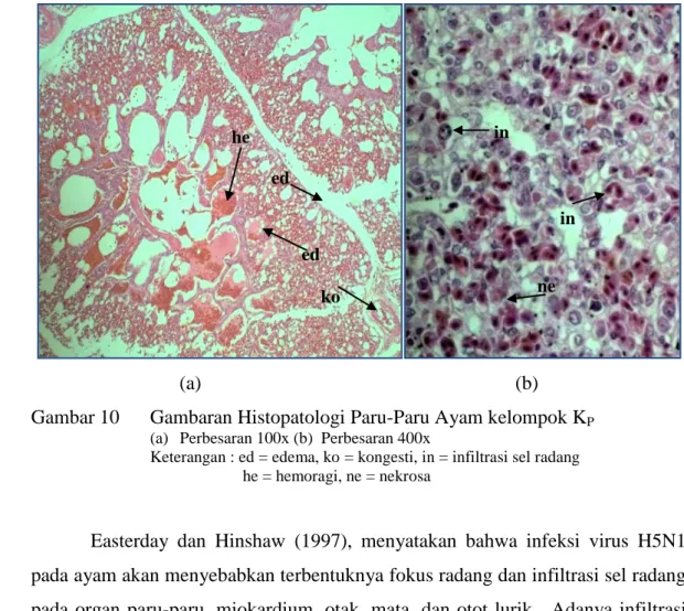 Gambar 10  Gambaran Histopatologi Paru-Paru Ayam kelompok K P (a)  Perbesaran 100x (b)  Perbesaran 400x 