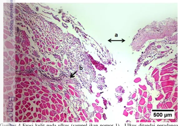 Gambar  4  Erosi  kulit  pada  ulkus  (sampel  ikan  nomor  1).    Ulkus  ditandai  peradangan  kulit  (a),  infiltrasi  sel  radang  (b)  pada  epidermis,  dermis,  dan  otot,  pewarnaan HE 