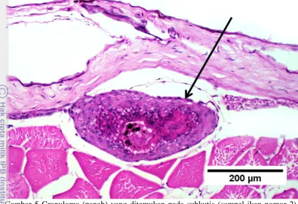 Gambar  6  Degenerasi  dan  nekrosis  pada  otot  (sampel  ikan  nomor  2),  terlihat  keberadaan  makrofag  (panah)  yang  memfagosit  jaringan  otot  nekrosa,  pewarnaan HE 