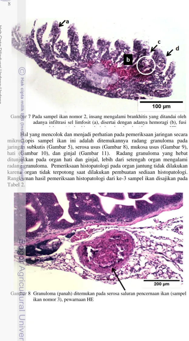 Gambar 7 Pada sampel ikan nomor 2, insang mengalami brankhitis yang ditandai oleh  adanya  infiltrasi  sel  limfosit (a), disertai  dengan  adanya  hemoragi  (b),  fusi  atau perlekatan (c), dan hiperplasia lamela sekunder (d), pewarnaan HE 