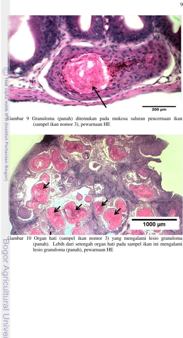 Gambar  9  Granuloma  (panah)  ditemukan  pada  mukosa  saluran  pencernaan  ikan  (sampel ikan nomor 3), pewarnaan HE 