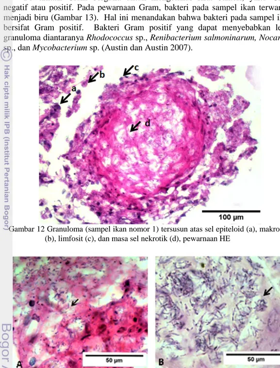 Gambar 13  Lesio granuloma pada ginjal (sampel ikan nomor 1) dengan pewarnaan HE  (A)  dan  Gram  (B)