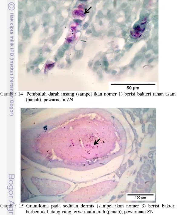Gambar  15  Granuloma  pada  sediaan  dermis  (sampel  ikan  nomer  3)  berisi  bakteri  berbentuk batang yang terwarnai merah (panah), pewarnaan ZN 