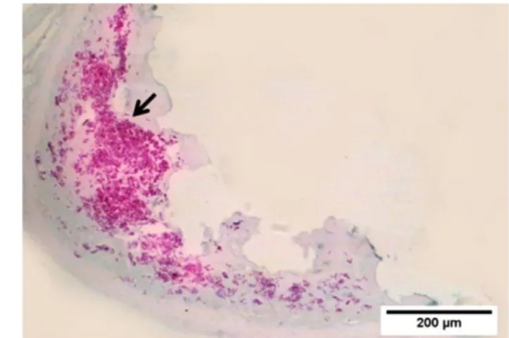 Gambar 17  Koloni bakteri tahan asam (panah) terdeteksi dalam granuloma pada ginjal  (sampel ikan nomor 1), perwarnaan ZN 