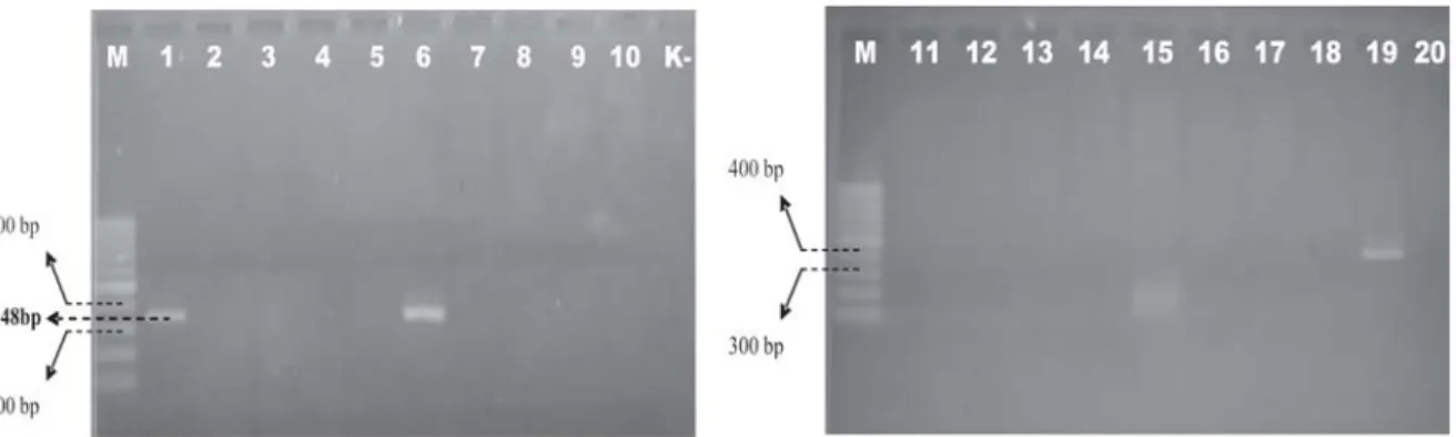 Gambar 1. Deteksi gen stx1  dengan primer LP30/31 pada Agarose 2%. Baris 1 kontrol positip : ATCC 43894;  baris 2-12 Feses manusia klinis yaitu; baris 2: KL52(7); baris 3: KL87(7); baris 4: