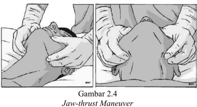 Gambar 2.4  Jaw-thrust Maneuver 