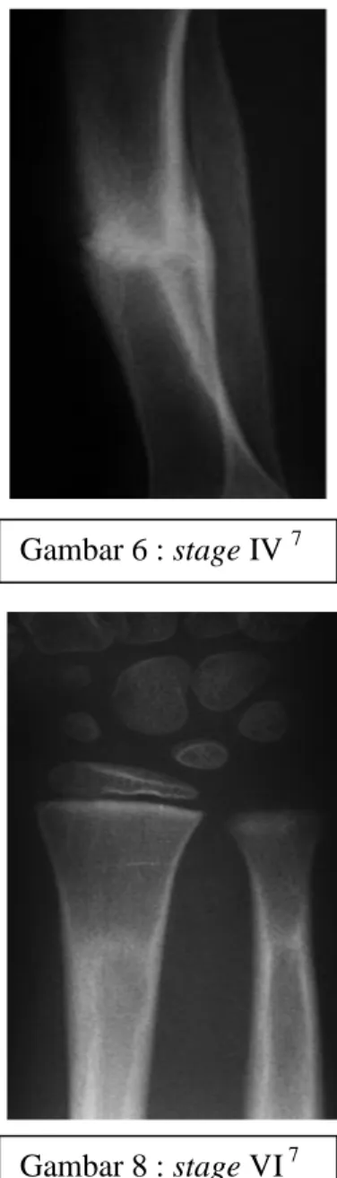 Gambar 7 : stage V  7  Gambar 8 : stage VI  7 