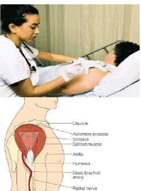 Gambar 2.2 Penyuntikan DPT secara Intra Muskular  (sumber : pnccenter.co.id) 