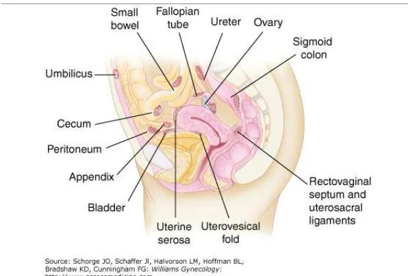 Gambar 2.8 Lokasi tersering terjadinya endometriosis (Dikutip dari 