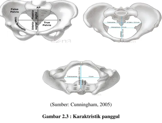Gambar 2.3 : Karaktristik panggul 