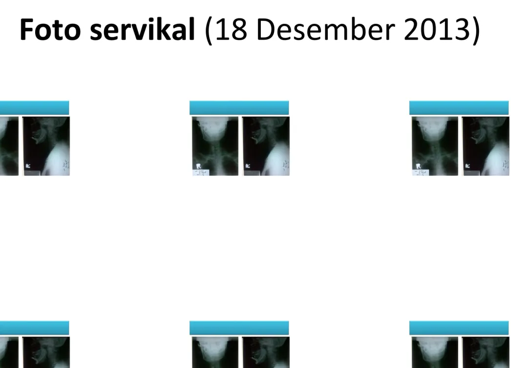 Foto servikal (18 Desember 2013)