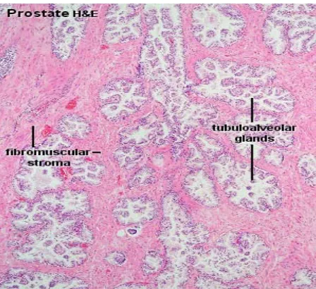Gambar 2.2. Histologi Kelenjar Prostat Normal  (School of Anatomy and Human Biology, 2009) 