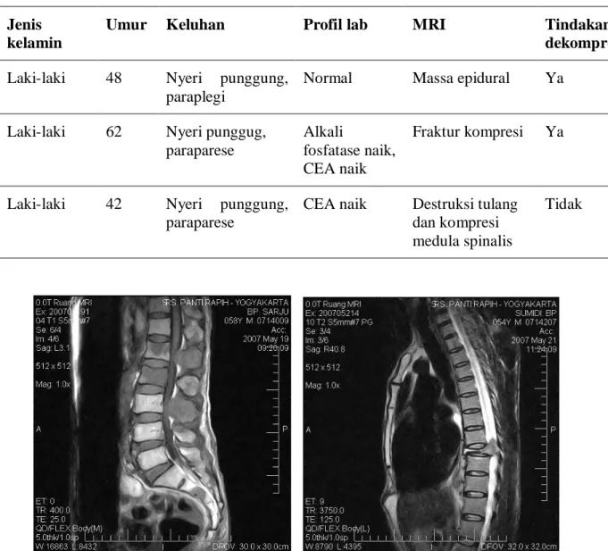 Tabel 1. Karateristik kasus dan gambaran klinis penderita tumor spinal metastase 