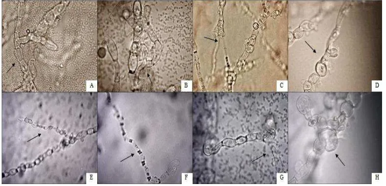 Gambar 4.4.1 Morfologi hifa abnormal hasil uji in vitro R. solani dengan bakteri endofit ditunjukkan oleh tanda panah (a) Normal; (b) Melengkung; (c) Patah; (d) Lisis; (e) Kerdil; (f) Keriting; (g) Patah dan lisis; (h) membengkak (Perbesaran 60 x10) 