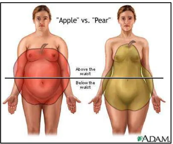 Gambar 2.2: Tipe Obesitas Android (Apple-Shaped() dan Obesitas Gynoid Pear-Shaped) (Sumber: Medline Plus, The A.D.A.M