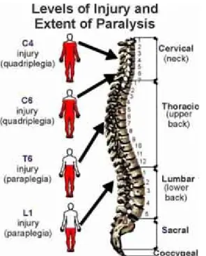 Gambar 7 : manifestasi plegi pada trauma medulla spinalis  (6)