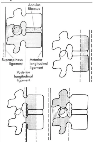 Gambar 1. Pembagian column vertebra menurut Denis
