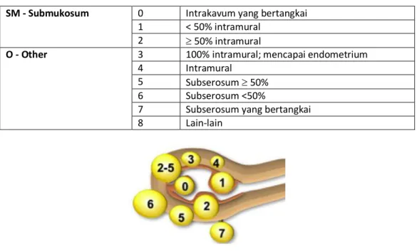 Tabel 1. Sistem Penulisan Klasifikasi Mioma Uteri 