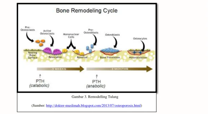 Gambar 3. Remodelling Tulang 