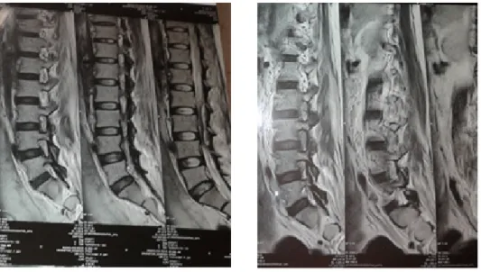 Gambar 1. MRI Pasien