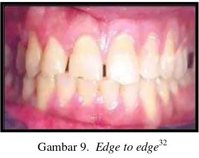 Gambar 9.  Edge to edge32 