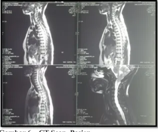 Gambar 6.   CT Scan  PasienSimpulan: