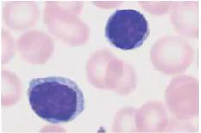 Gambar 5. Limfosit normal. Dikutip dari Theml  35 