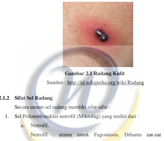 Gambar 2.1 Radang Kulit 