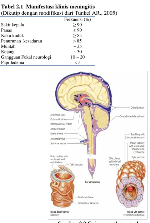 Tabel 2.1  Manifestasi klinis meningitis 